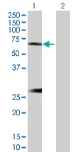 Western blot - Anti-IL-6R antibody (AB103798)