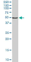 Western blot - Anti-IL-6R antibody (AB103798)