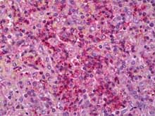 Immunohistochemistry (Formalin/PFA-fixed paraffin-embedded sections) - Anti-IL-6R antibody (AB128008)