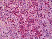 Immunohistochemistry (Formalin/PFA-fixed paraffin-embedded sections) - Anti-IL-6R antibody (AB128008)