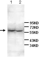 Western blot - Anti-IL-6R antibody (AB128008)