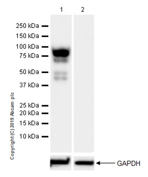 Western blot - Anti-IL-6R antibody [EPR22628-236] (AB222101), expandable thumbnail