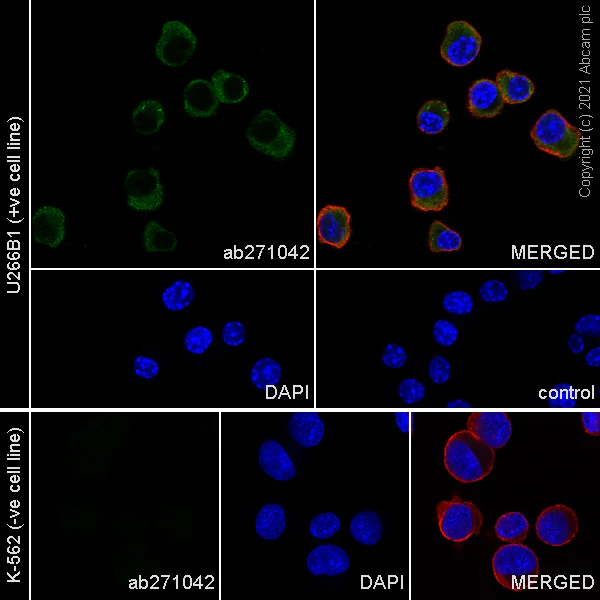 Immunocytochemistry/ Immunofluorescence - Anti-IL-6R antibody [EPR24322-143] (AB271042)