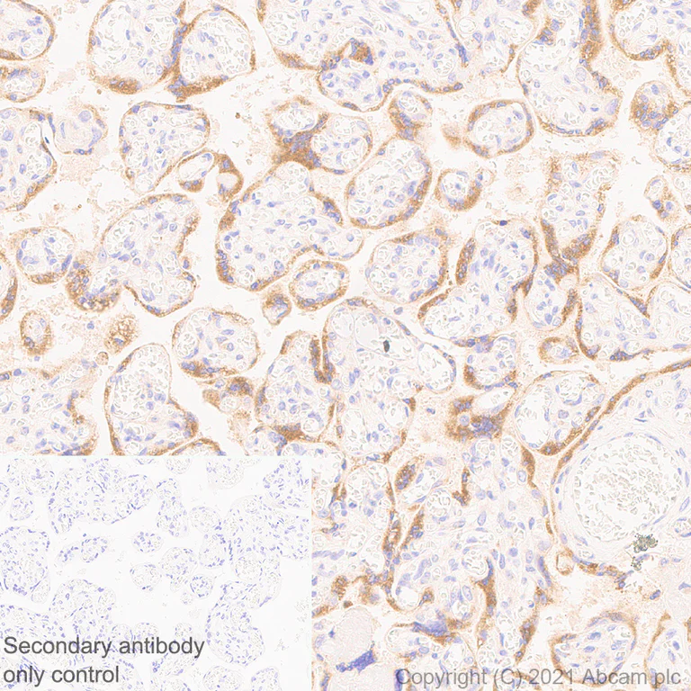 Immunohistochemistry (Formalin/PFA-fixed paraffin-embedded sections) - Anti-IL-6R antibody [EPR24322-143] (AB271042)