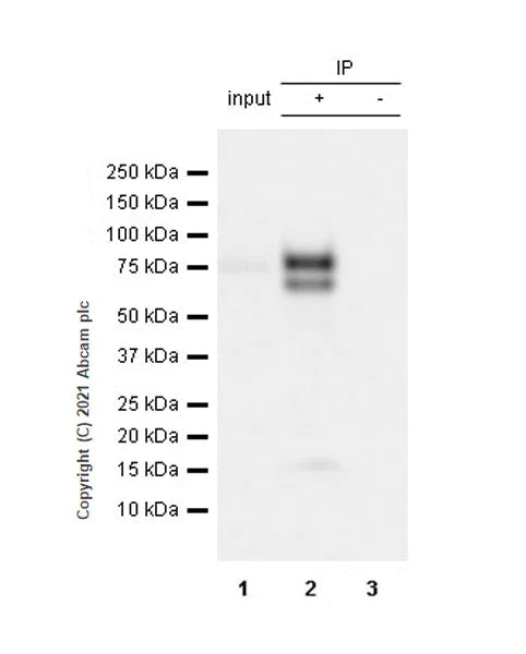 Immunoprecipitation - Anti-IL-6R antibody [EPR24322-143] (AB271042)
