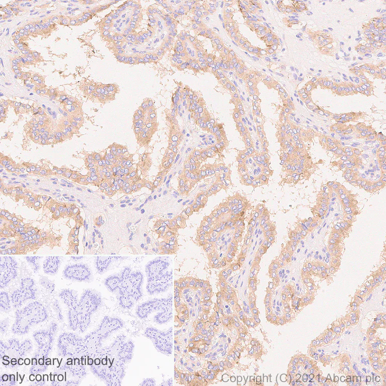 Immunohistochemistry (Formalin/PFA-fixed paraffin-embedded sections) - Anti-IL-6R antibody [EPR24322-143] - BSA and Azide free (AB280573)