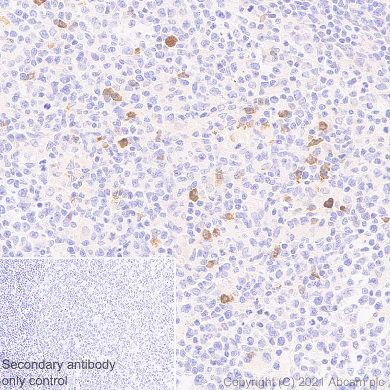 Immunohistochemistry (Formalin/PFA-fixed paraffin-embedded sections) - Anti-IL-6R antibody [EPR24322-143] - BSA and Azide free (AB280573)