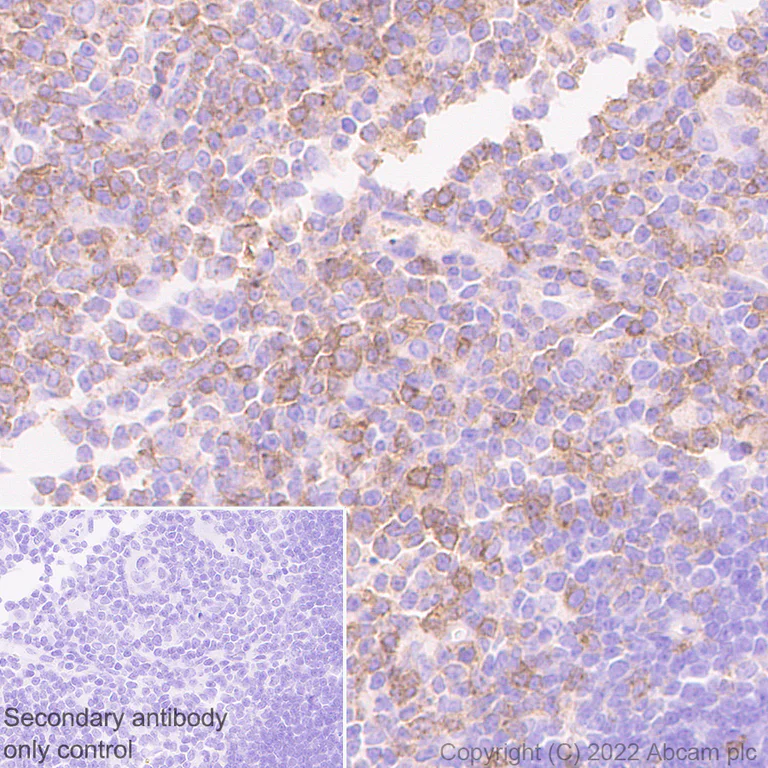 Immunohistochemistry (Formalin/PFA-fixed paraffin-embedded sections) - Anti-IL-6R antibody [EPR26370-132] (BSA and Azide free) (AB300582)