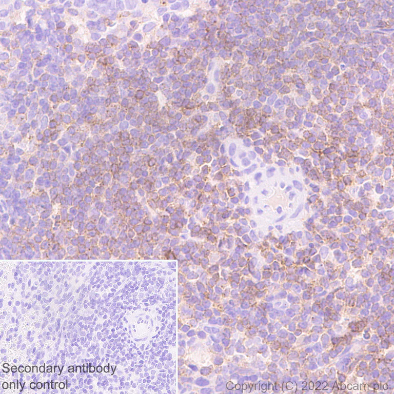 Immunohistochemistry (Formalin/PFA-fixed paraffin-embedded sections) - Anti-IL-6R antibody [EPR26370-132] (BSA and Azide free) (AB300582)