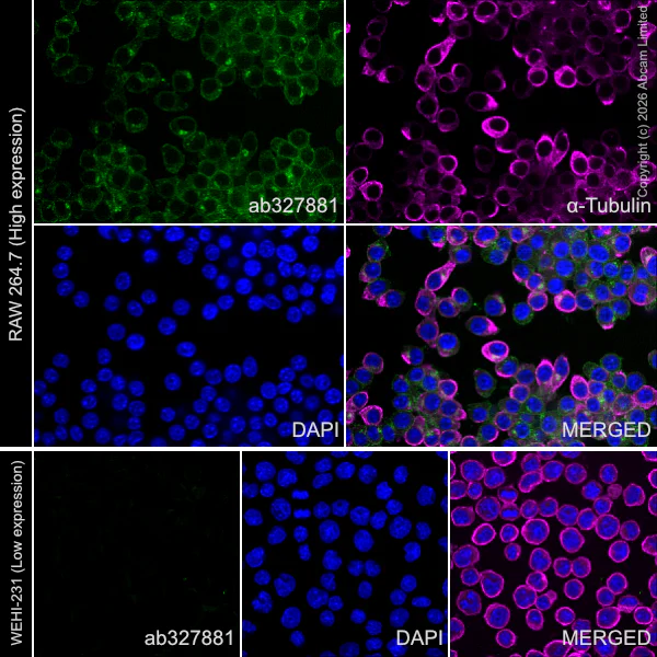 Immunocytochemistry/ Immunofluorescence - Anti-IL-6R antibody [EPR30382-502] - BSA and Azide free, low endotoxin (AB327881)