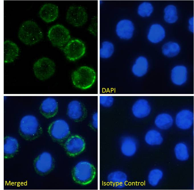 Immunocytochemistry/ Immunofluorescence - Anti-IL-6R antibody [rhPM-1 (Tocilizumab)] (AB275982), expandable thumbnail