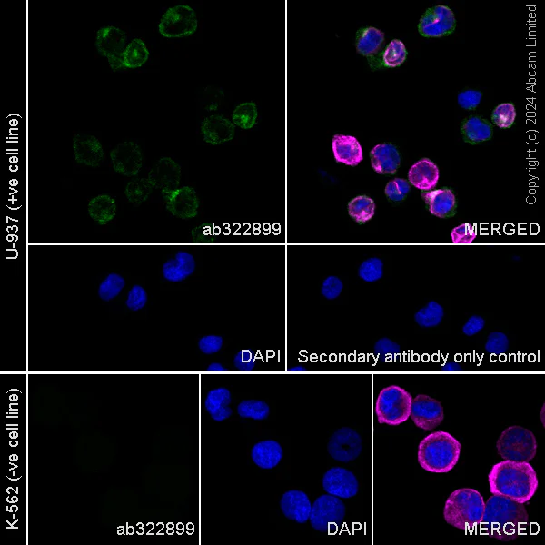 Immunocytochemistry/ Immunofluorescence - Anti-IL-6R antibody [RM2071] (AB322899)