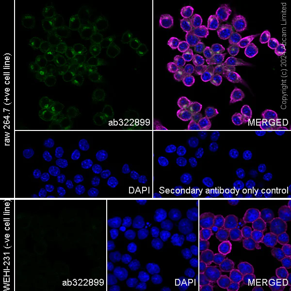 Immunocytochemistry/ Immunofluorescence - Anti-IL-6R antibody [RM2071] (AB322899)