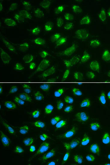 Immunocytochemistry/ Immunofluorescence - Anti-IL-7 antibody (AB175380)