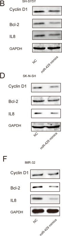 Western blot - Anti-IL-8 antibody [807] (AB18672), expandable thumbnail
