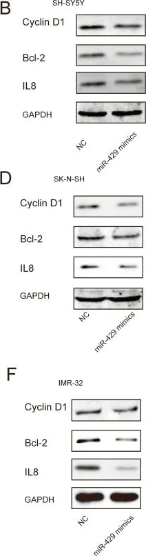 Western blot - Anti-IL-8 antibody [807] (AB18672)