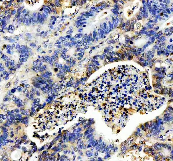 Immunohistochemistry (Formalin/PFA-fixed paraffin-embedded sections) - Anti-IL-8 antibody (AB106350)
