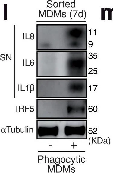 Western blot - Anti-IL-8 antibody (AB106350)