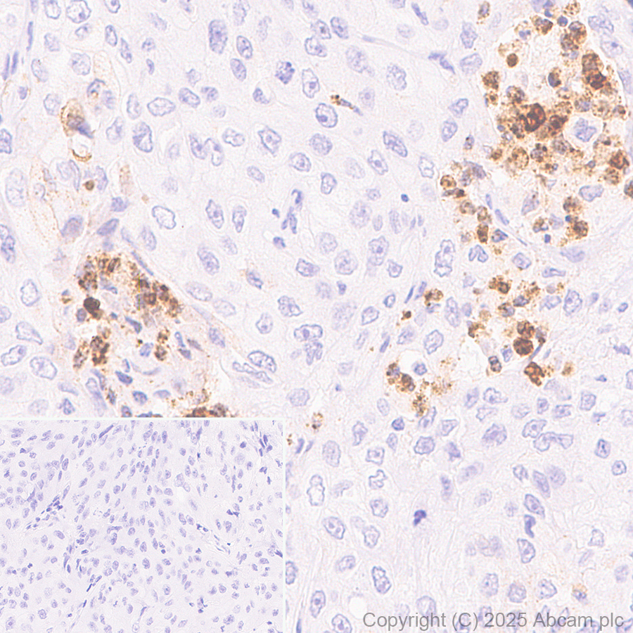 Immunohistochemistry (Formalin/PFA-fixed paraffin-embedded sections) - Anti-IL-8 antibody [EPR19358-37] - BSA and Azide free (Capture) (AB242515), expandable thumbnail