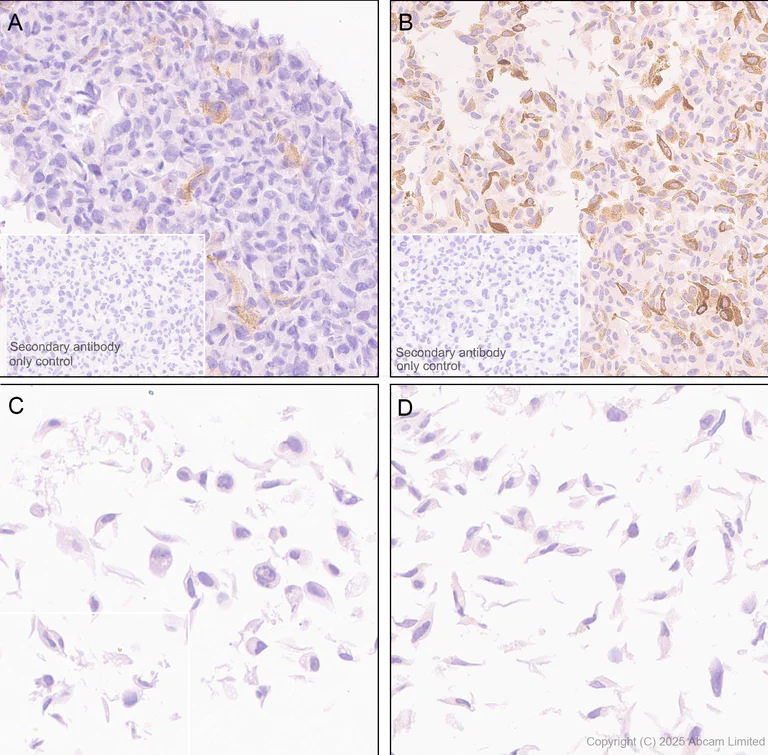 Immunohistochemistry (Formalin/PFA-fixed paraffin-embedded sections) - Anti-IL-8 antibody [EPR19358-37] - BSA and Azide free (Capture) (AB242515)