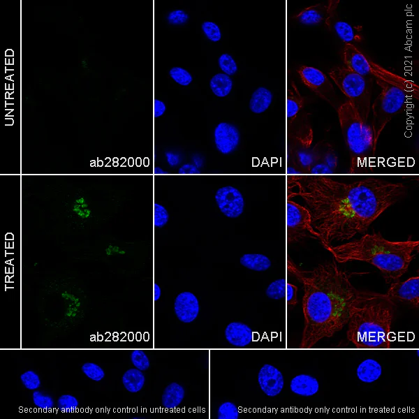 Immunocytochemistry/ Immunofluorescence - Anti-IL-8 antibody [O-IL8-15] - Mouse IgG2a (Chimeric) - BSA and Azide free (AB282027)