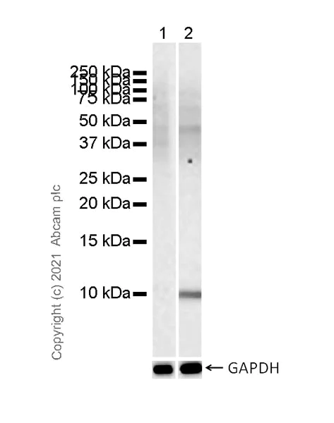 Western blot - Anti-IL-8 antibody [O-IL8-15] - Mouse IgG2a (Chimeric) - BSA and Azide free (AB282027)