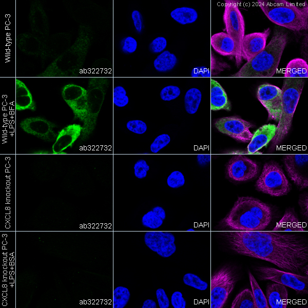 Immunocytochemistry/ Immunofluorescence - Anti-IL-8 antibody [RM1267] (ab322732), expandable thumbnail