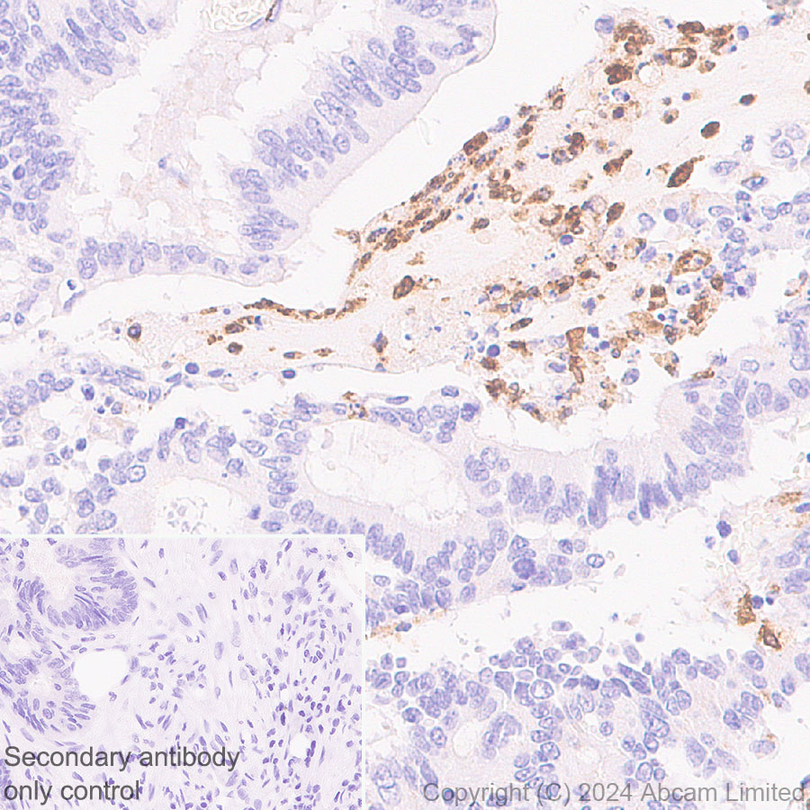 Immunohistochemistry (Formalin/PFA-fixed paraffin-embedded sections) - Anti-IL-8 antibody [RM1267] (ab322732), expandable thumbnail