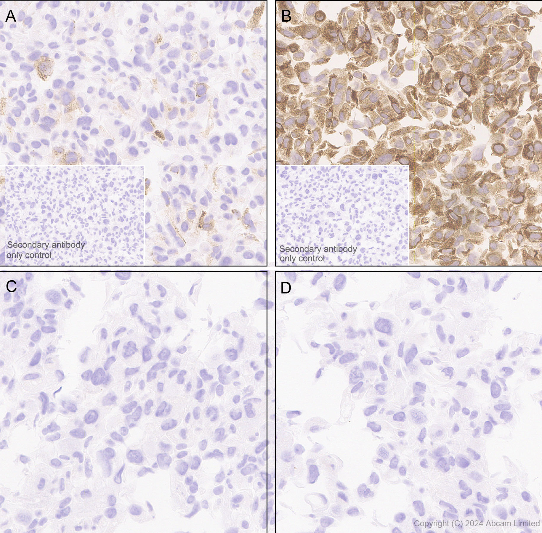 Immunohistochemistry (Formalin/PFA-fixed paraffin-embedded sections) - Anti-IL-8 antibody [RM1267] (AB322732), expandable thumbnail