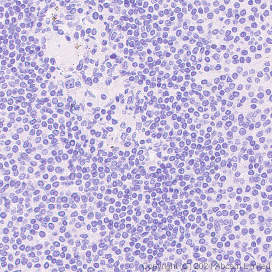 Immunohistochemistry (Formalin/PFA-fixed paraffin-embedded sections) - Anti-IL-8 antibody [RM1267] (AB322732), expandable thumbnail