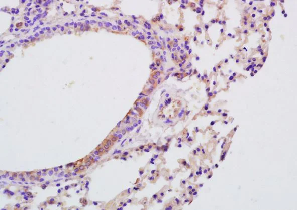 Immunohistochemistry (Formalin/PFA-fixed paraffin-embedded sections) - Anti-IL-9 antibody (AB203386)