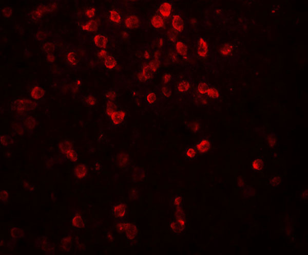 Immunohistochemistry (Formalin/PFA-fixed paraffin-embedded sections) - Anti-IL-9 antibody - C-terminal (AB181397)