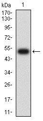 Western blot - Anti-IL-9R antibody [4A11H2] (AB233757), expandable thumbnail