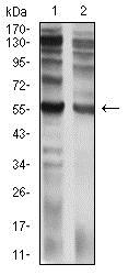 Western blot - Anti-IL-9R antibody [4A11H2] (AB233757), expandable thumbnail