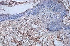Immunohistochemistry (Formalin/PFA-fixed paraffin-embedded sections) - Anti-IL1 Receptor I/IL-1R-1 antibody (AB106278)