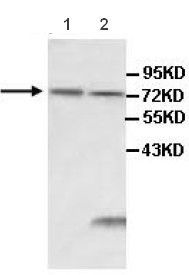 Western blot - Anti-IL1 Receptor I/IL-1R-1 antibody (AB106278)