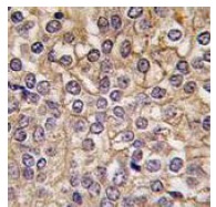 Immunohistochemistry (Formalin/PFA-fixed paraffin-embedded sections) - Anti-IL1 Receptor I/IL-1R-1 antibody - C-terminal (AB190078), expandable thumbnail
