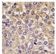 Immunohistochemistry (Formalin/PFA-fixed paraffin-embedded sections) - Anti-IL1 Receptor I/IL-1R-1 antibody - C-terminal (AB190078)