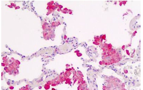 Immunohistochemistry (Formalin/PFA-fixed paraffin-embedded sections) - Anti-IL1 Receptor I/IL-1R-1 antibody - C-terminal (AB190078), expandable thumbnail