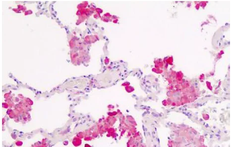 Immunohistochemistry (Formalin/PFA-fixed paraffin-embedded sections) - Anti-IL1 Receptor I/IL-1R-1 antibody - C-terminal (AB190078)