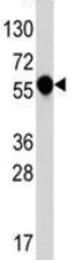 Western blot - Anti-IL1 Receptor I/IL-1R-1 antibody - C-terminal (AB190078)