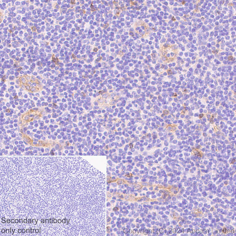 Immunohistochemistry (Formalin/PFA-fixed paraffin-embedded sections) - Anti-IL1 Receptor I/IL-1R-1 antibody [EPR20150-241] - BSA and Azide free (Detector) (AB244859)