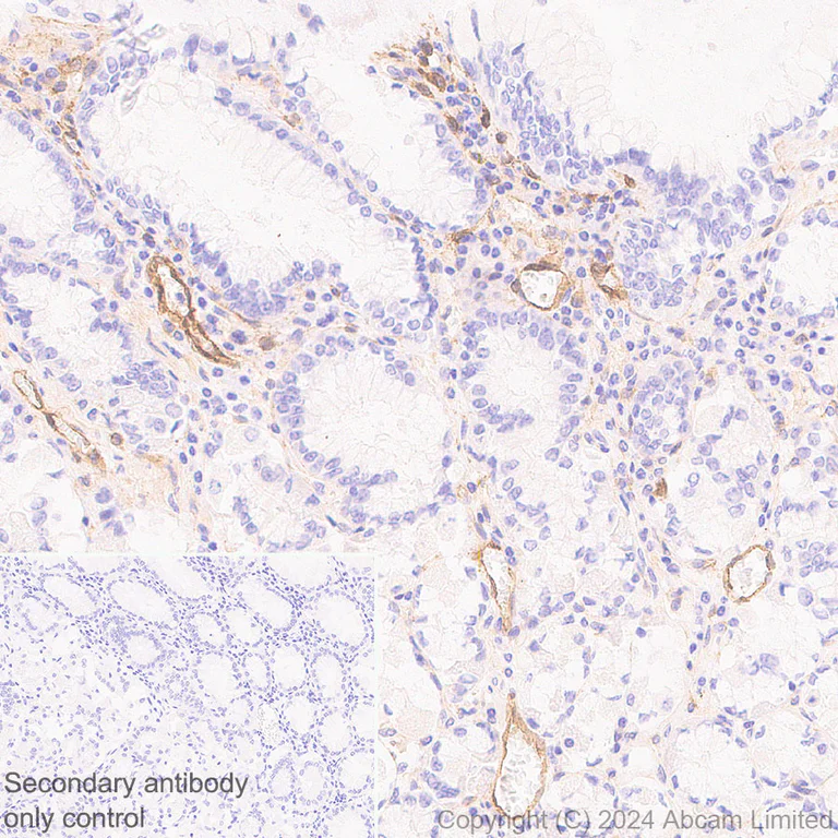 Immunohistochemistry (Formalin/PFA-fixed paraffin-embedded sections) - Anti-IL1 Receptor I/IL-1R-1 antibody [EPR20150-241] - BSA and Azide free (Detector) (AB244859)