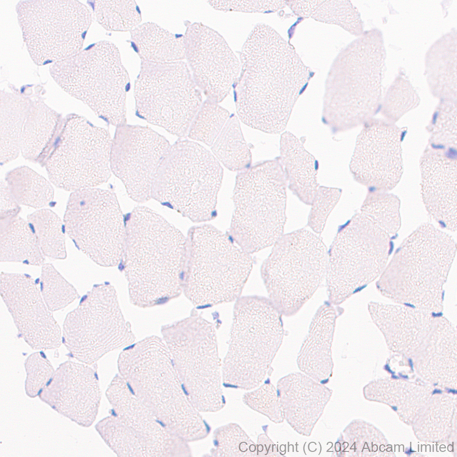 Immunohistochemistry (Formalin/PFA-fixed paraffin-embedded sections) - Anti-IL1 Receptor I/IL-1R-1 antibody [EPR20150-241] - BSA and Azide free (Detector) (AB244859)