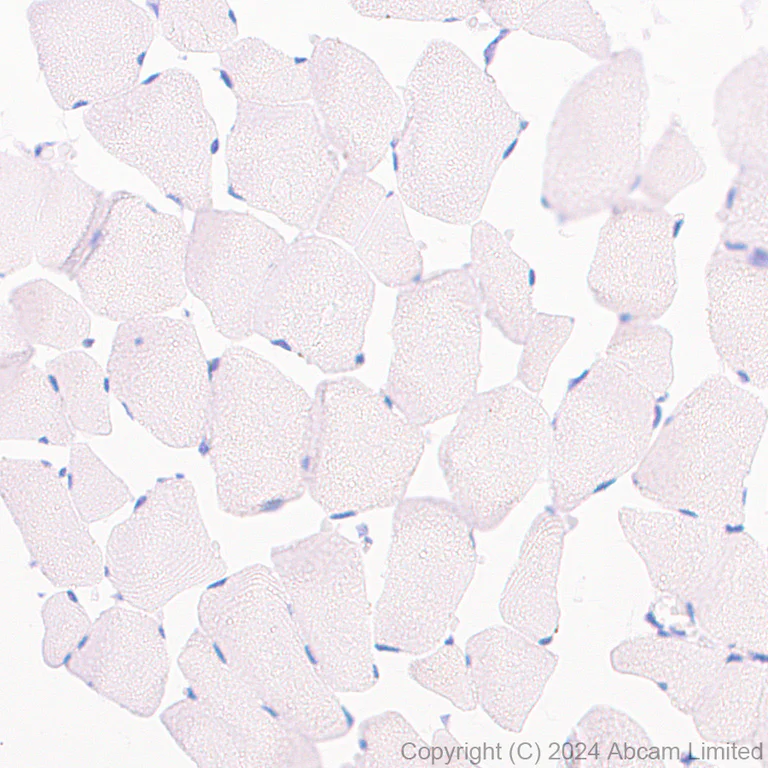 Immunohistochemistry (Formalin/PFA-fixed paraffin-embedded sections) - Anti-IL1 Receptor I/IL-1R-1 antibody [EPR20150-241] - BSA and Azide free (Detector) (AB244859)