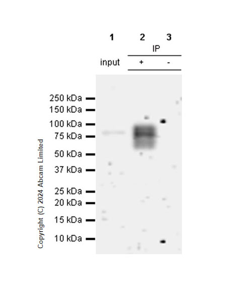 Immunoprecipitation - Anti-IL1 Receptor I/IL-1R-1 antibody [RM1242] (AB322149), expandable thumbnail