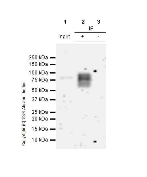 Immunoprecipitation - Anti-IL1 Receptor I/IL-1R-1 antibody [RM1242] (AB322149)