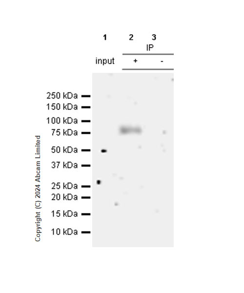 Immunoprecipitation - Anti-IL1 Receptor I/IL-1R-1 antibody [RM1242] (AB322149), expandable thumbnail
