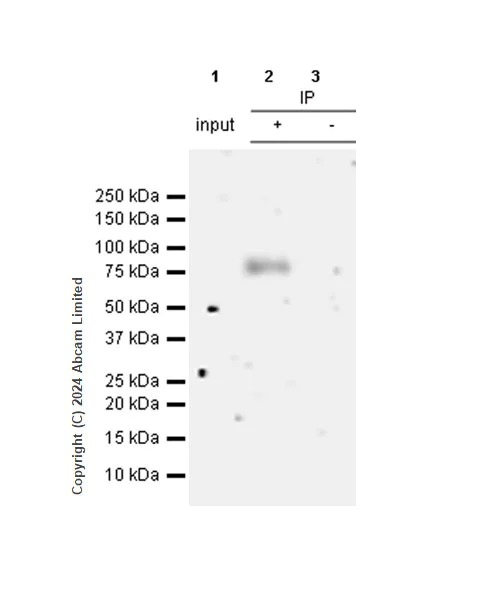 Immunoprecipitation - Anti-IL1 Receptor I/IL-1R-1 antibody [RM1242] (AB322149)