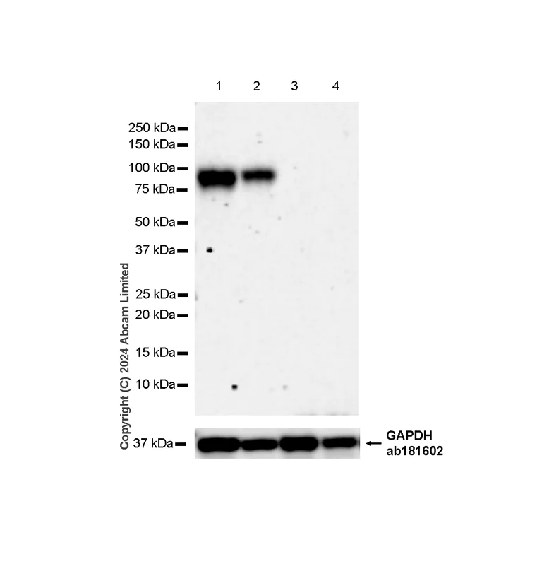 Western blot - Anti-IL1 Receptor I/IL-1R-1 antibody [RM1242] (AB322149)